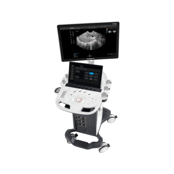 Sonoscape P9 Ultrasound