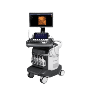 Sonoscape S50 – Ultrasound