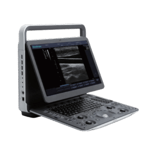 Sonoscape E2 – Ultrasound